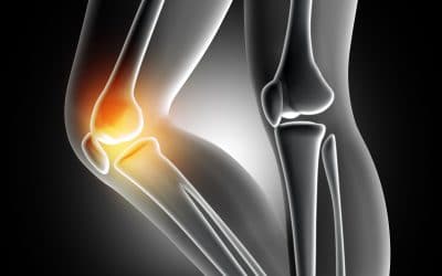 Could changing what you eat help your joint pain?